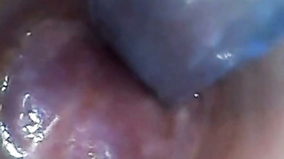 Endoscope POV - Test Tube Cock Urethral Insertion (480)