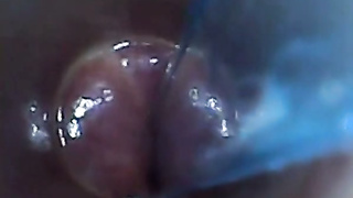 Endoscope POV - Test Tube Cock Urethral Insertion (480)
