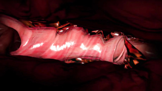 Jill Doggo saga part 4